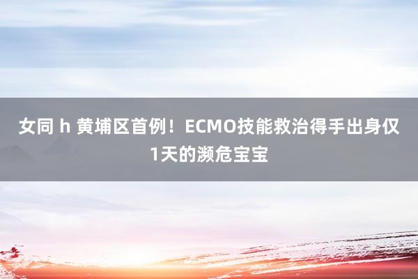 女同 h 黄埔区首例！ECMO技能救治得手出身仅1天的濒危宝宝